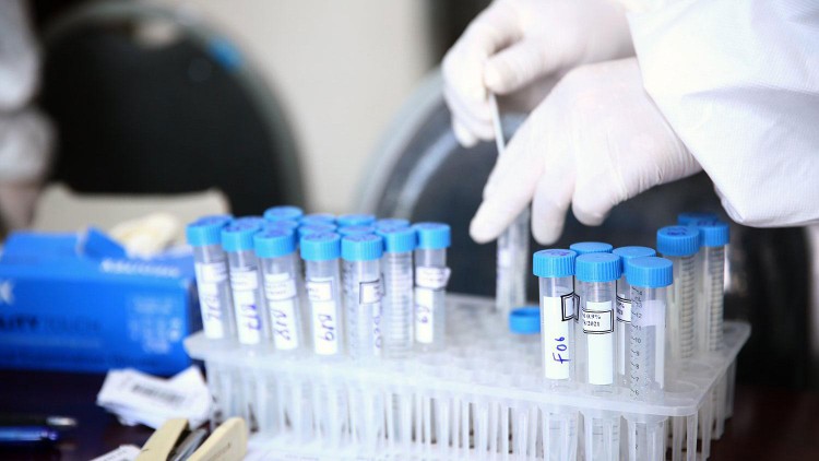 Nhiều đơn vị chống dịch trên cả nước đã sử dụng sản phẩm kit xét nghiệm Covid-19 RT-PCR do Công ty TNHH Thiết bị B.D.E cung cấp. Ảnh minh họa: Tiên Giang