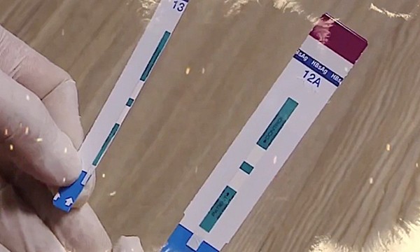 Test xét nghiệm nhanh bị nhân viên khoa Vi sinh, Bệnh viện  đa khoa Xanh Pôn cắt đôi để dùng cho 2 bệnh nhân. Ảnh: L.N.